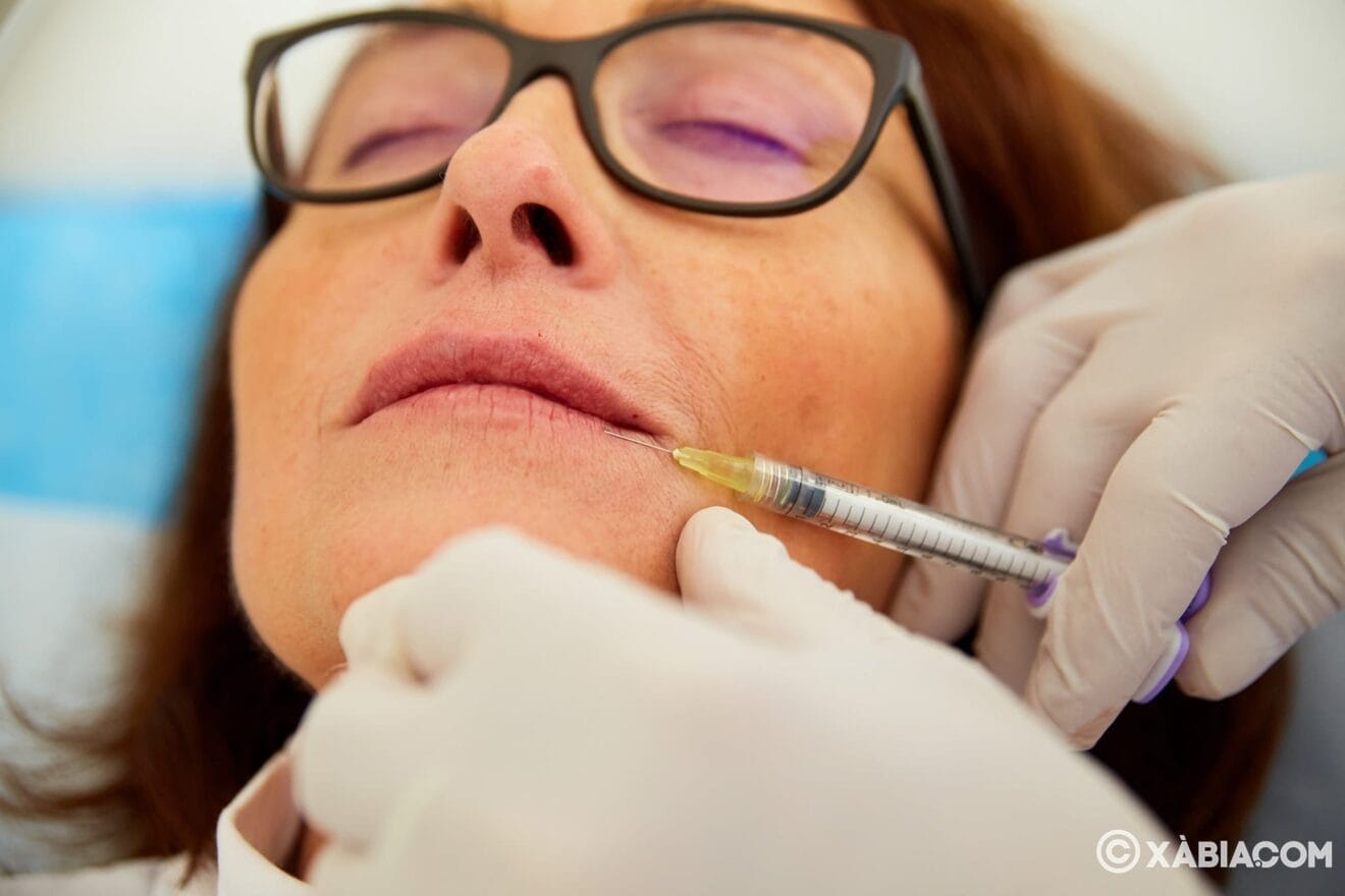 acido hialuronico en javea policlinica cume