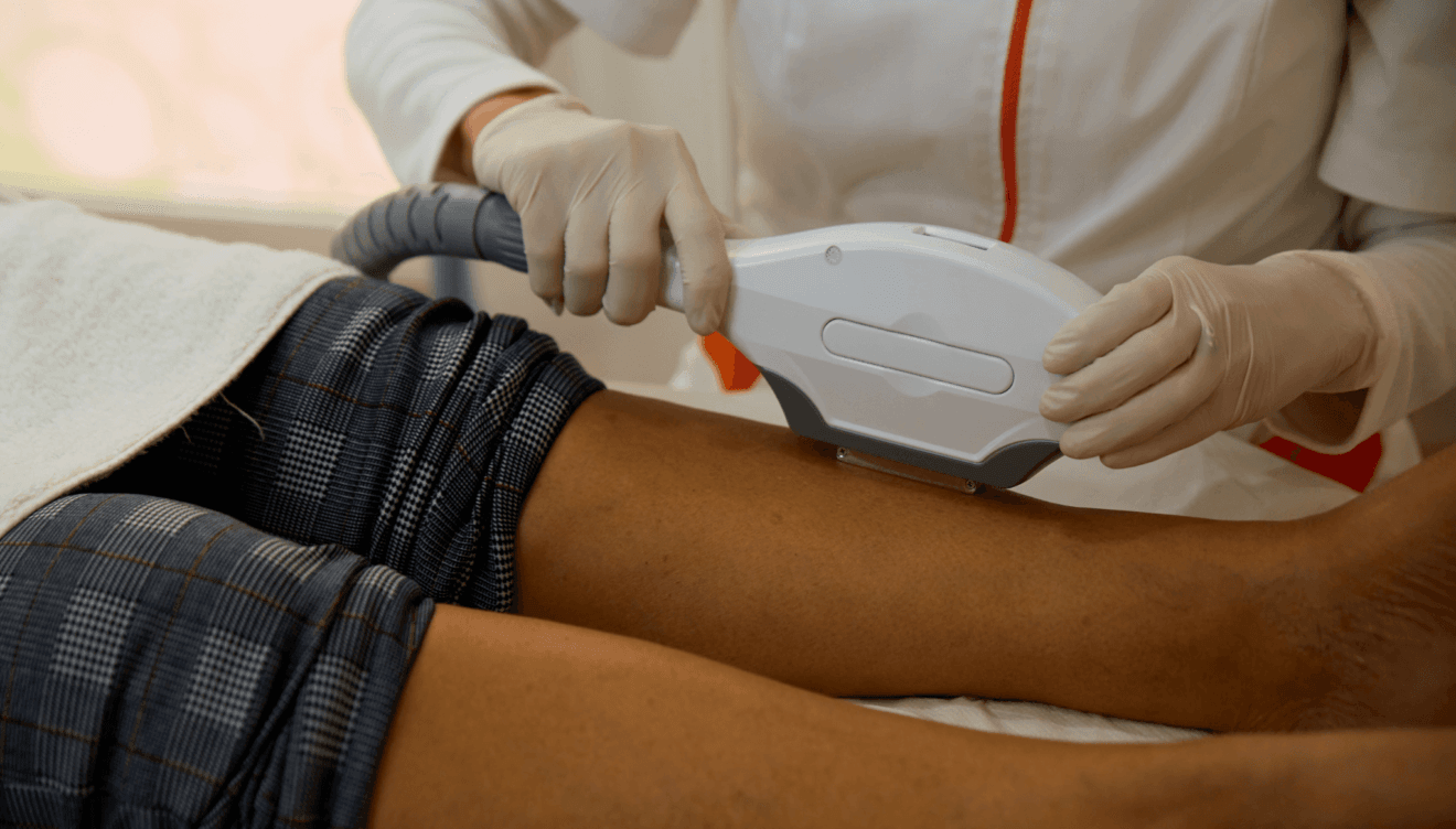 Sorteo de depilación láser Policlínica CUME