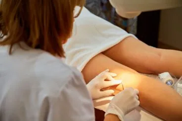 elimina las varices por completo con los tratamientos de policlinica cume