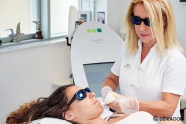 Láser facial – Clínica Doctora Castelblanque