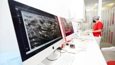 Radiografías de tu boca en Dénia