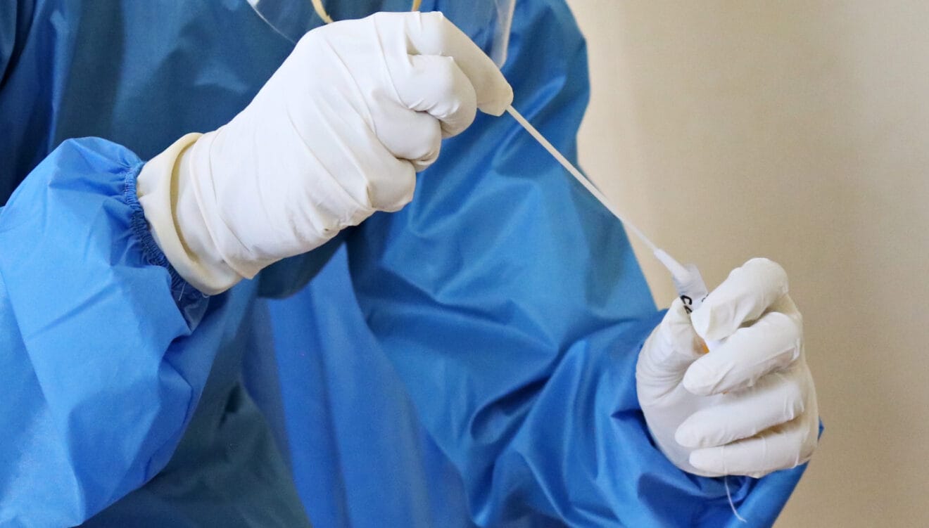Realízate tu test COVID en clínica Fevan