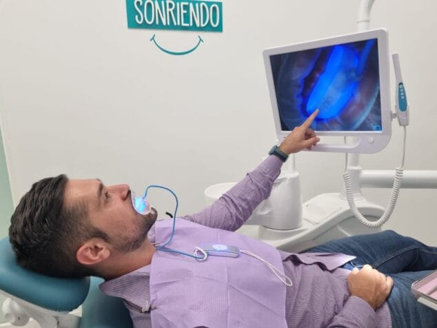 Imagen: Blanqueamiento dental en Clinica AlmiDental