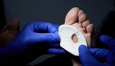 Cuidado integral y prevención de lesiones en el pie diabético