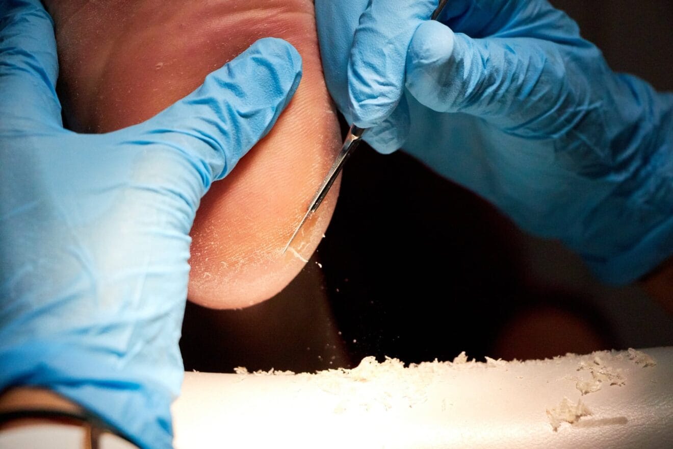 Podologo Denia – Clinica Podologica Estevez