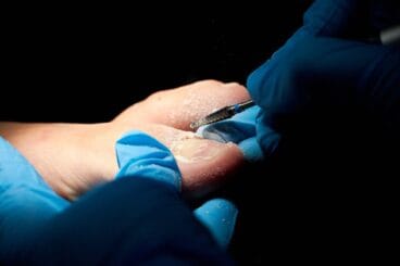 Podologos en Denia – Clinica Podologica Estevez