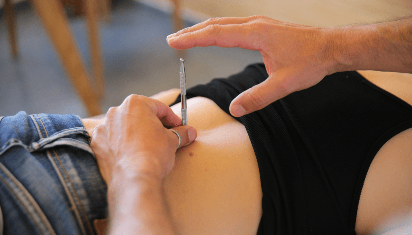 Acupuntura en Dénia - Centre fisiobioestétic