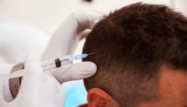 tratamiento capilar de policlinica cume