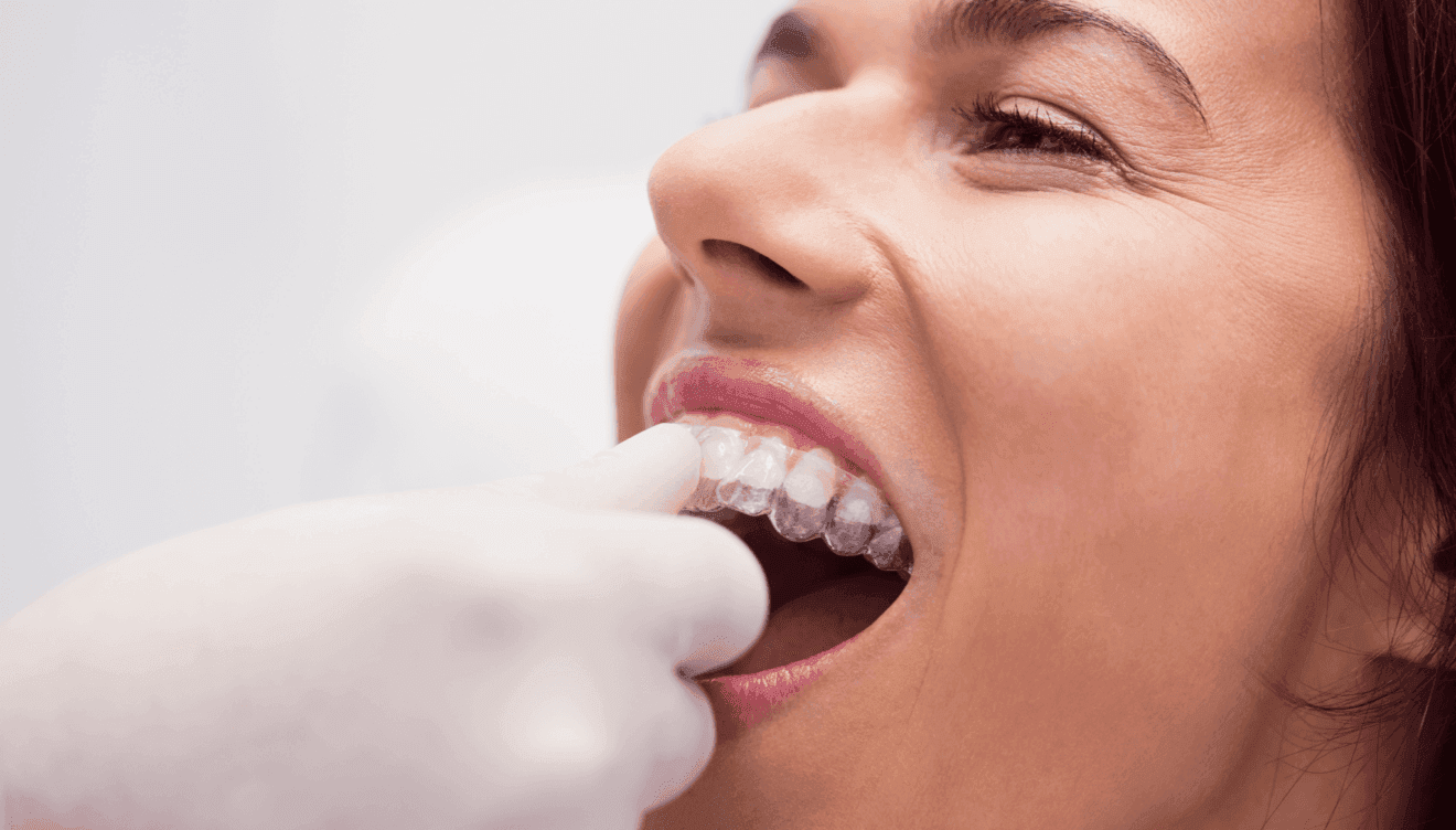 Invisalign es un tratamiento indoloro