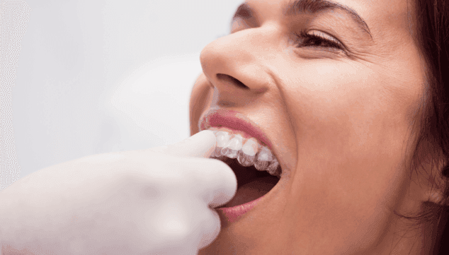 invisalign es un tratamiento indoloro