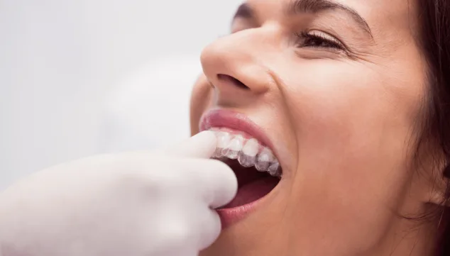Olvídate de los brackets y consigue una sonrisa perfecta con esta ortodoncia invisible 1 Imagen: Invisalign es un tratamiento indoloro