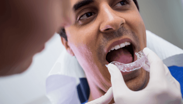 Olvídate de los brackets y consigue una sonrisa perfecta con esta ortodoncia invisible 3 Imagen: Invisalign, sistema de ortodoncia invisible