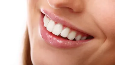 solo el dentista debe determinar si un paciente es apto o no para un blanqueamiento