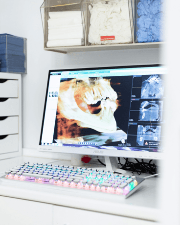 Diagnóstico dental preciso y personalizado para una sonrisa saludable