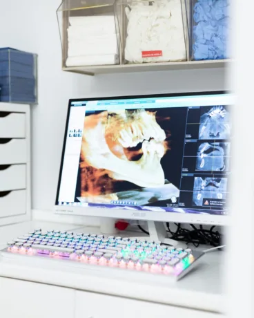 Diagnóstico dental preciso y personalizado para una sonrisa saludable