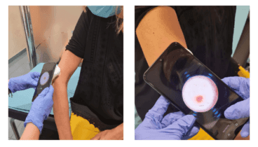 HCB Calpe pone a tu disposición los servicios dermatológicos