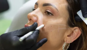 en clinica medica montgo te ofrecen un servicio integral empezado por la evaluacion de tu piel