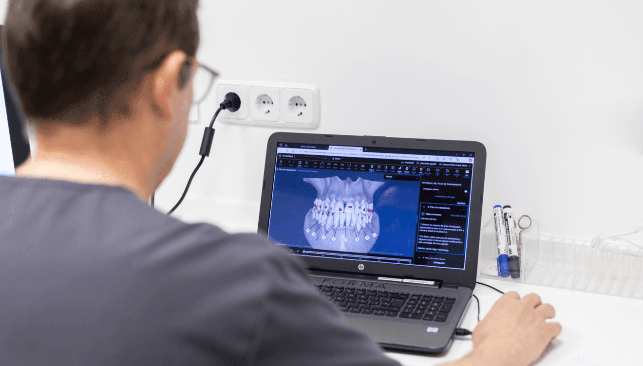 Tecnología pionera para recuperar la sonrisa