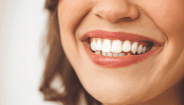 bereik de perfecte harmonie en pronk deze zomer met je glimlach