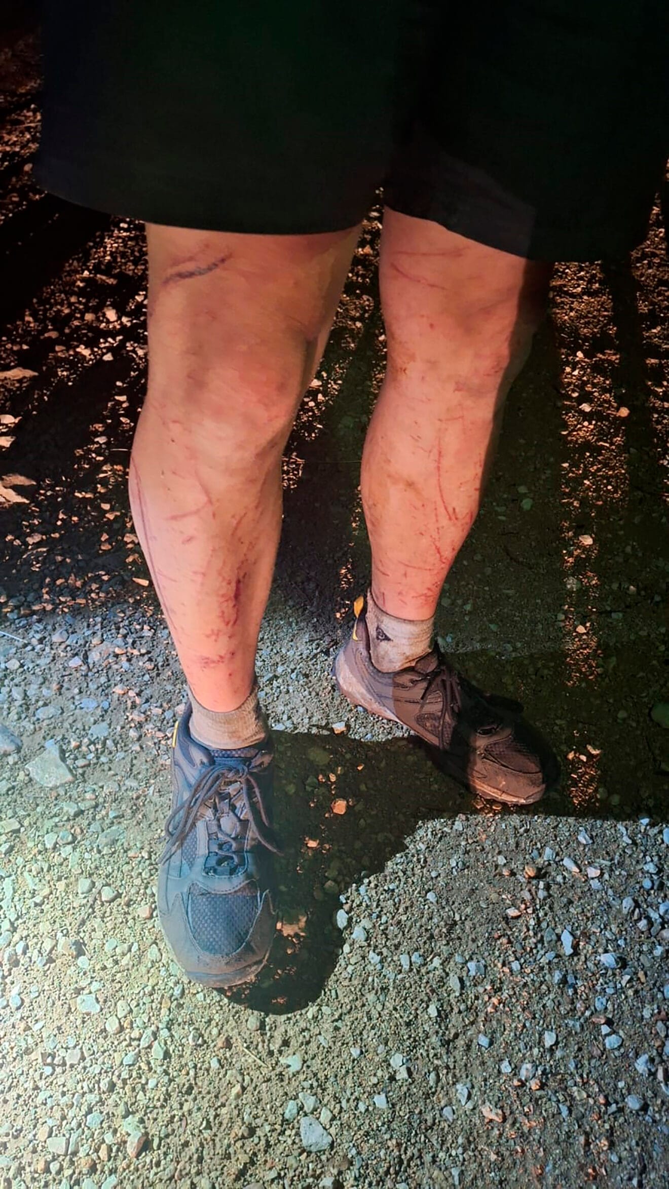 Heridas del senderista rescatado en la Serra de Segària