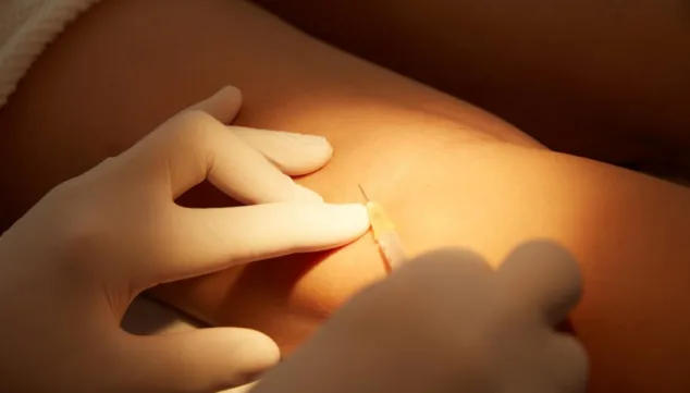 La razón de por qué debes eliminar tus varices 7 Imagen: Cómo eliminar tus varices de forma segura y efectiva