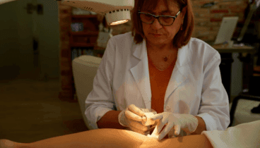 Elimina tus varices y mejora tu bienestar