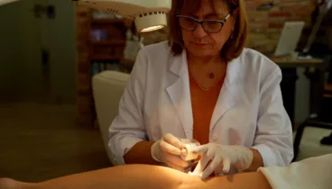 Elimina tus varices y mejora tu bienestar