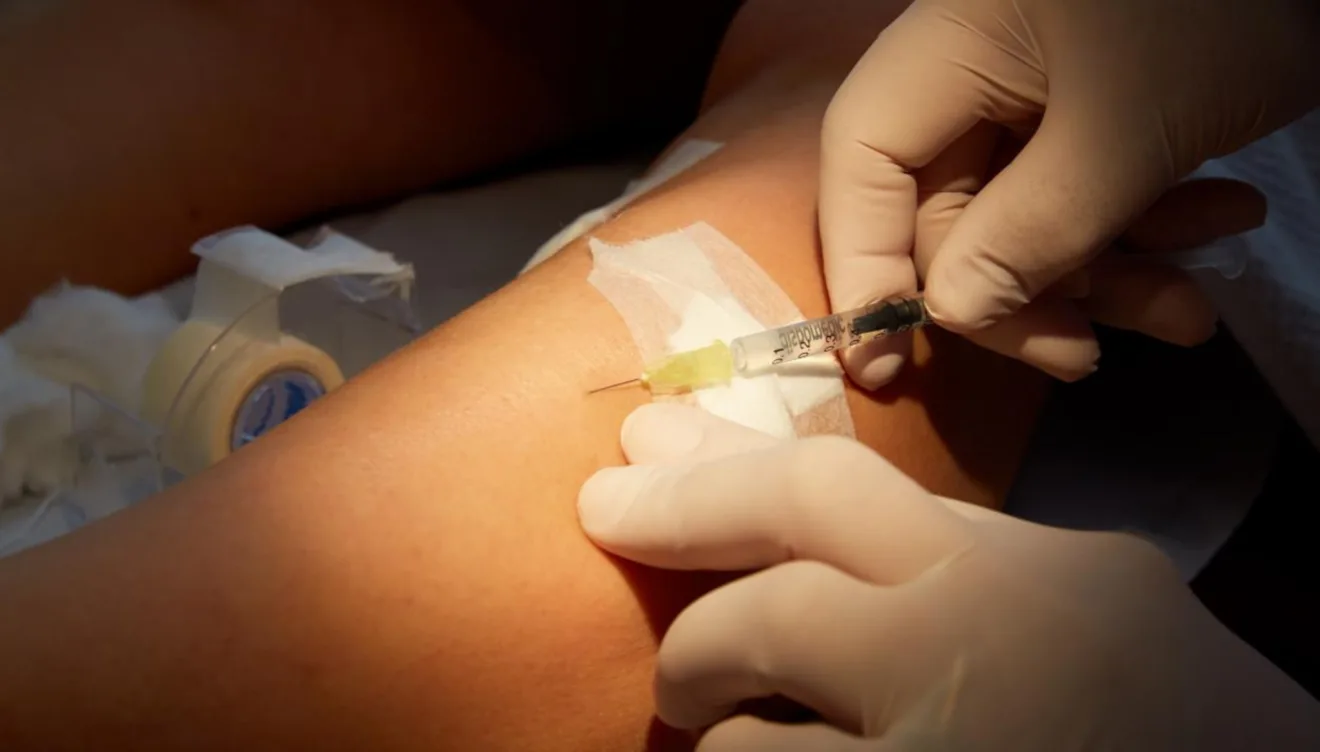 Varices: tratamientos avanzados para piernas saludables