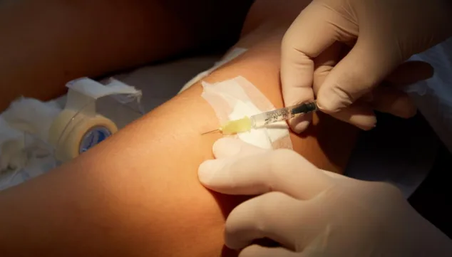 La razón de por qué debes eliminar tus varices 10 Imagen: Varices: tratamientos avanzados para piernas saludables