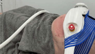 Reduce la grasa localizada con Criolipólosis