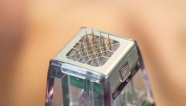 Tratamiento de radriofrecuencia fraccionada con microagujas de oro