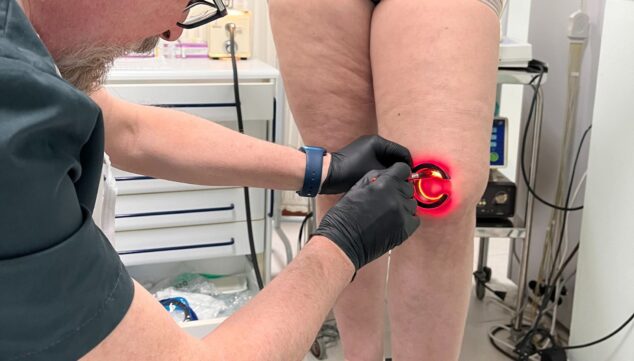 Imagen: Especialista aplicando tratamiento de esclerosis en varicesmultilingüe en Dénia