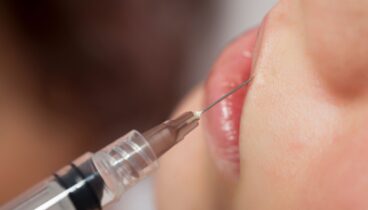 Clínica Estética Castelblanque especialista en código de barras labial en Dénia