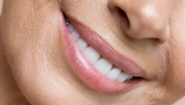 Cómo eliminar el código de barras labial con ácido hialurónico