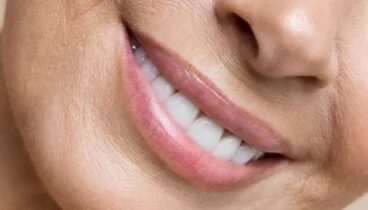 Cómo eliminar el código de barras labial con ácido hialurónico