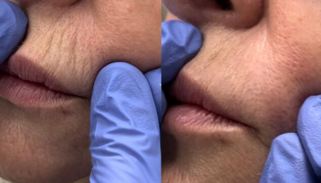 Imagen: Di adiós al código de barras