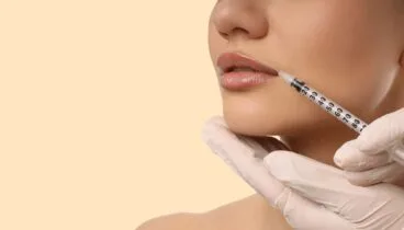 Soluciones médico estéticas para el código de barras en los labios