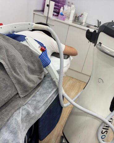 Criolipolisis, fuera grasa gracias al frío