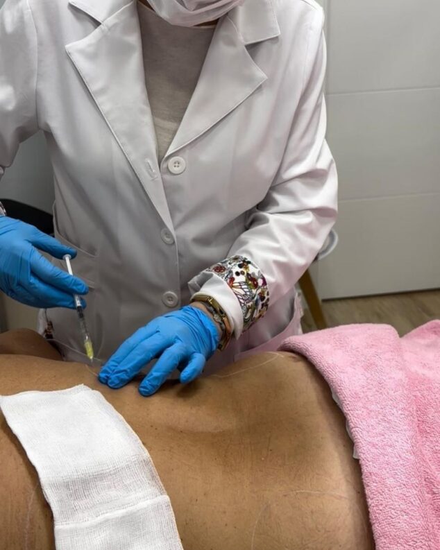 mesoterapia oxigena disuelve y fuera flacidez