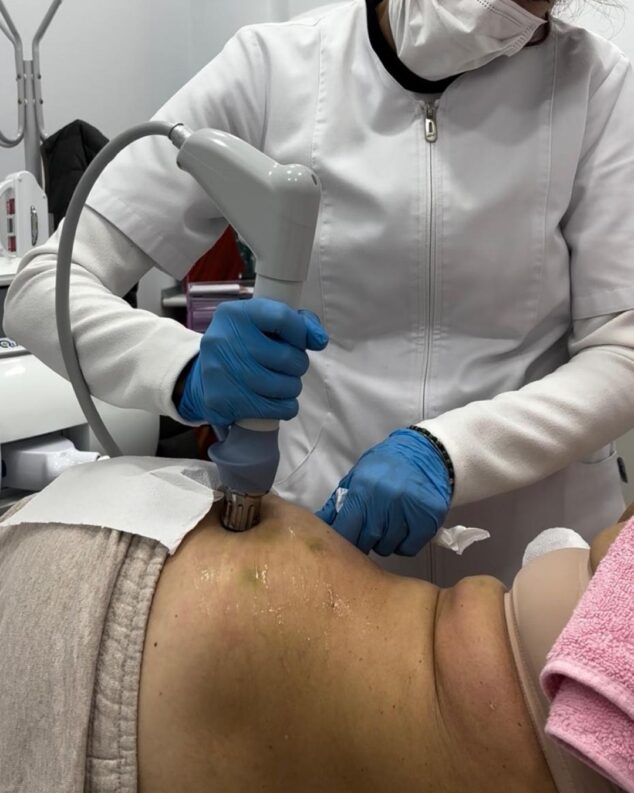 ondas de choque rompe los nodulos de celulitis y mejora la circulacion