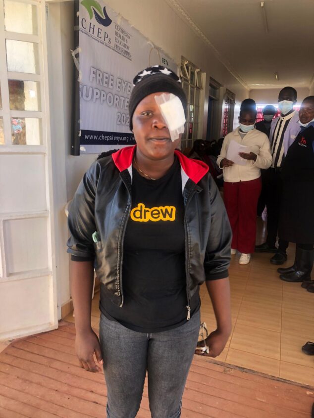 Mujer joven en Kenia con un parche blanco en el ojo izquierdo tras una operación de cataratas.