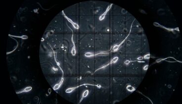 detalle de espermatozoides bajo la lente de un microscopio