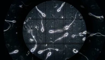 detalle de espermatozoides bajo la lente de un microscopio