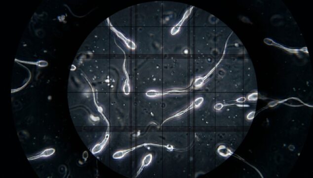 detalle de espermatozoides bajo la lente de un microscopio