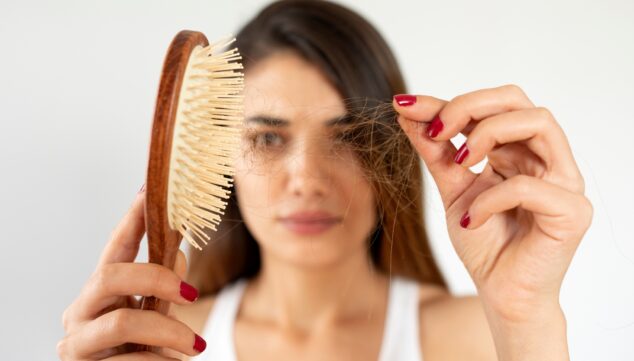 la perdida de cabello genera una gran preocupacion en miles de personas