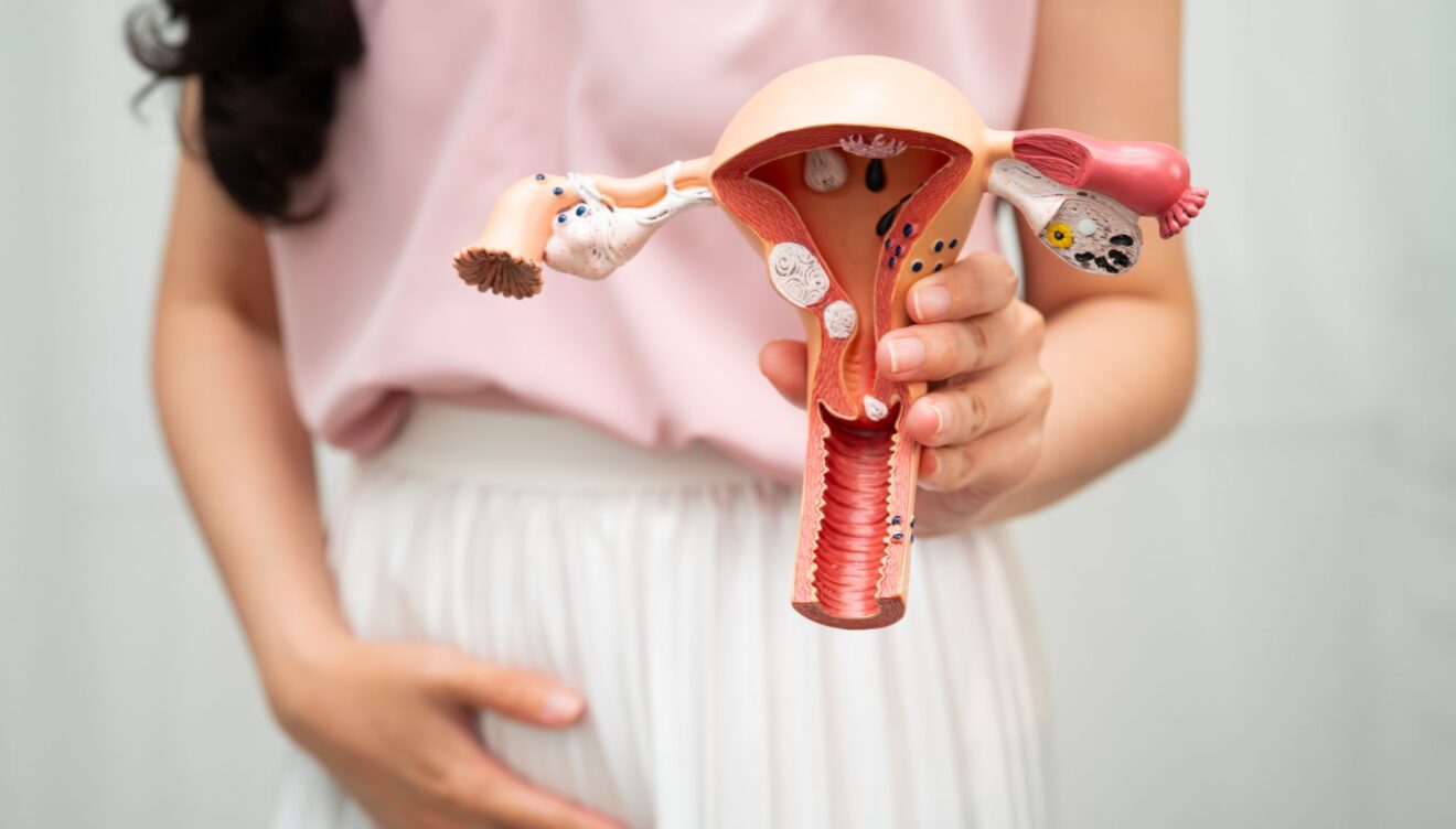 Preparación endometrial sencilla