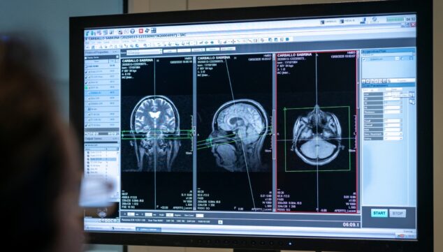 Fallos de memoria y atención: cuándo conviene pedir ayuda 5 estimulacion y rehabilitacion cognitiva