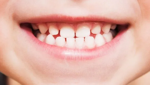 higiene bucodental infantil